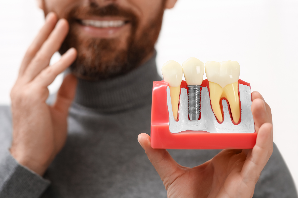 Transform Your Smile in 2026 with Dental Implants